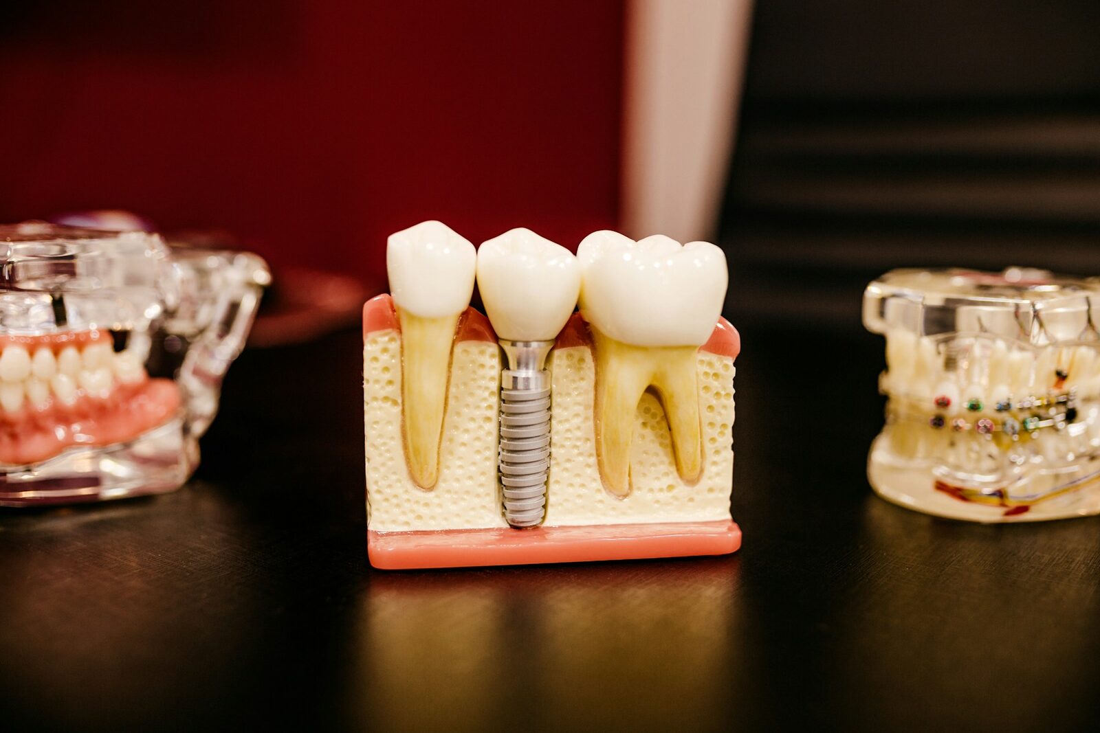 Stockmotiv zur Planung von Zahnersatz und Implantaten